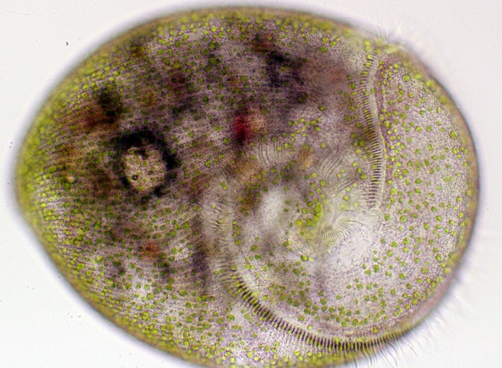 Stentor Amethystinus: Die violetten Granula sind bevorzugt entlang der Wimpernreihen angeordnet. Ein zur Nahrungsaufnahme dienendes spiraliges Wimpernband führt in den Zellmund.  