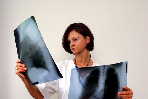 Ärztin mit Röntgenbilder 