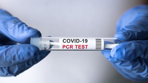 Hände in Gummihandschuhen halten ein Röhrchen mit Beschriftung Covid-19 PCR Test