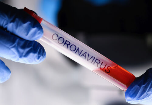 Behandschuhte Hände halten Teströhrchen mit Aufschrift Coronavirus