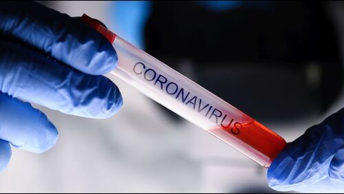 Hände in Handschuhen halten Reagenzröhrchen mit Aufschrift Coronavirus